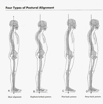 Posture Chart