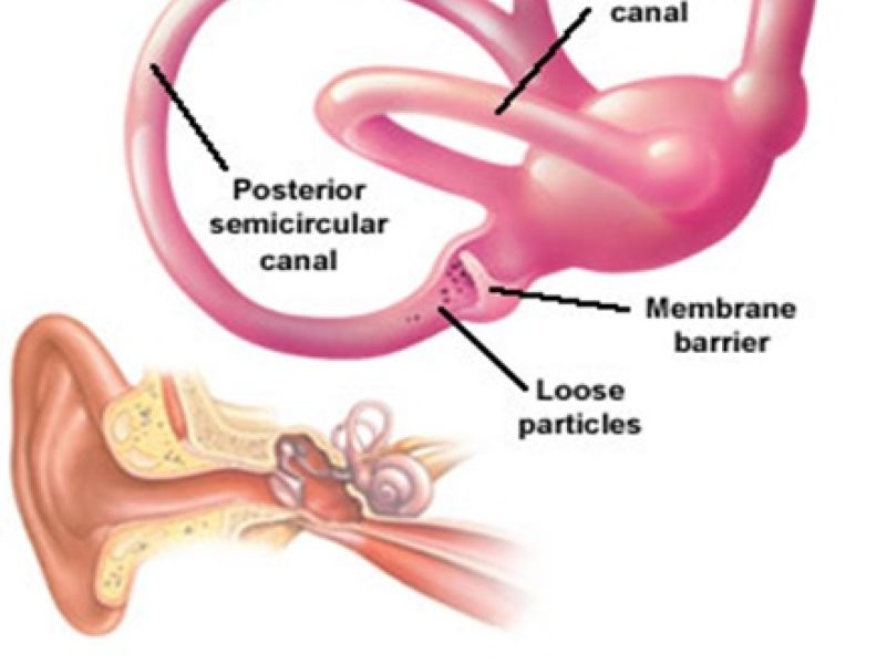 Inner Ear